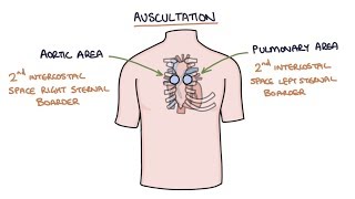 Heart Murmurs and Heart Sounds Visual Explanation for Students [upl. by Sitto]