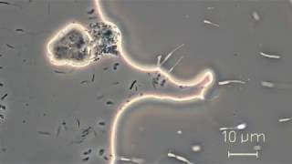 Stalked bacteria  Caulobacter spp [upl. by Suiramed696]