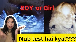 Nub Test hai kya  Nuchal Transcluency  Boy or Girl gender prediction [upl. by Tavis223]