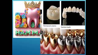 Introduction to Fixed Prosthodontics مقدمة عن التركيبات الثابتة [upl. by Asset587]