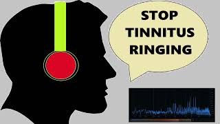 High Pitch Tinnitus Sound Therapy  Tinnitus High Frequency [upl. by Tommie]