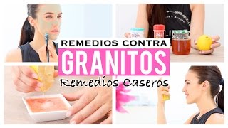 5 remedios caseros para eliminar los granitos [upl. by Ruperto]