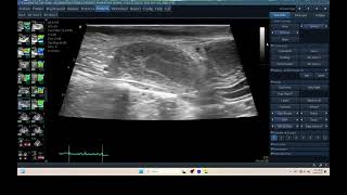 IQ 315 PYOMETRA ULTRASOUND ECHOPAC ANALYSIS UTERUS 2 [upl. by Alec]