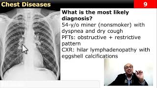 Chest case Diagnose it internalmedicine cme usmle محاضراتباطنة ecg clinical [upl. by Juana]