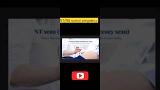 Pregnancy ultrasoundNTNB scanusgscanytshortsshortvideonuchaltransleucencyDownSyndrome [upl. by Essilem]