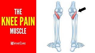 The Knee Pain Muscle How to Release It for INSTANT RELIEF [upl. by Gnos]