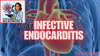 INFECTIVE ENDOCARDITIS [upl. by Aeslehc832]