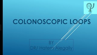 Colonoscopic loops [upl. by Lilah]