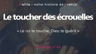 Le toucher des écrouelles  quotle roi te touche Dieu te guéritquot [upl. by Hutson]