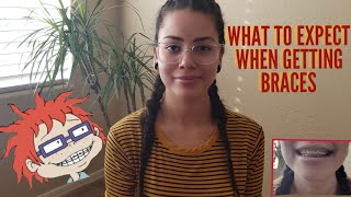 WHAT TO EXPECT WHEN GETTING BRACES  BRACES UPDATE  LUZ VEGA [upl. by Akienahs]