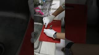 Biopsy  grossing of tissue  thyroid biopsy  thyroid tissue youtubeshorts biopsy tissue lab [upl. by Linda]