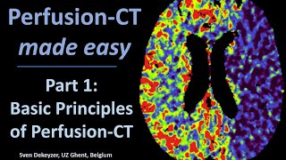 Perfusion CT made easy  part 1  Principles of Perfusion CT [upl. by Senaj207]