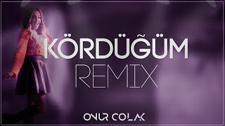 Ceren Cennet  Kördüğüm  Onur Colak Remix [upl. by Eiser]