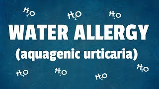 Water Allergy 10 Interesting Facts About Aquagenic Urticaria [upl. by Esilehc558]