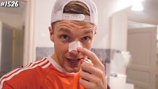 WAT IS ER MET MIJN NEUS  ENZOKNOL VLOG 1526 [upl. by Antoni596]