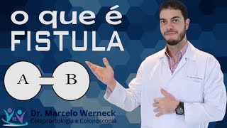 O que é fístula  Dr Marcelo Werneck [upl. by Amalberga]