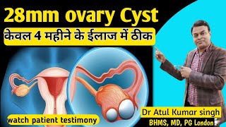 ovary Cyst treatment  Homeopathic treatment of ovarian cyst  ovary की गाँठ को कैसे ठीक करें [upl. by Arutek]