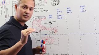 Atherosclerosis Pathology and Cellular Events [upl. by Akerahs]