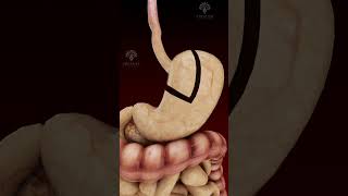 Gastric Bypass Laparoscopic Treatment shorts  creativelearning3d [upl. by Xenophon993]