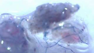 Morgellons organism  200x [upl. by Zerk]