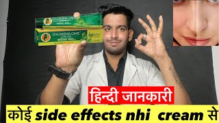 कोई side effects nhi cream से  Chloasma care cream  Chloasma care cream review  Chloasma care [upl. by Foscalina]