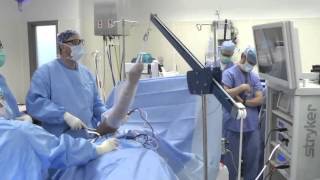 Shoulder Arthroscopy Surgery [upl. by Debi]