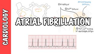 Atrial Fibrillation Overview  ECG types pathophysiology treatment complications [upl. by Fanestil871]