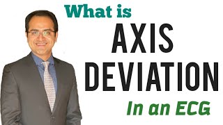 Axis Deviation in ECG Made Easy Causes How to determine Axis in ECG Explained ECG Lecture USMLE [upl. by Kavanagh]