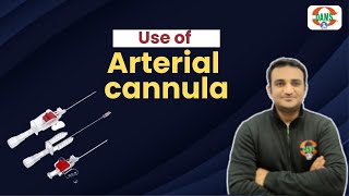 Use of Arterial cannula  DAMS Nursing [upl. by Irmo]