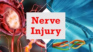 Nerve Injury [upl. by Oisorbma]