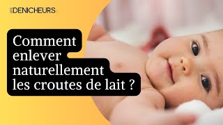 🚼 Comment enlever naturellement les croutes de lait chez un bébé 👶 🍼 [upl. by Sosna]