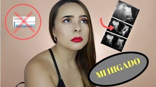 Mi historia con el ACNE me enferme del hígado Karomakeup [upl. by Brenan]