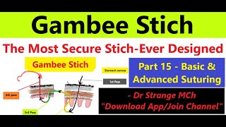 Mastering Gambee Stitch Compact Advanced Suturing Part 15 surgicalmastery surgerytrainees [upl. by Hershell]