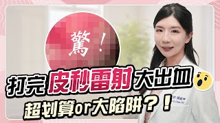 美or痛你選誰？｜打完「皮秒雷射」大出血就是賺到？真實價值大揭秘！｜陳詩珮醫師 [upl. by Dominik732]