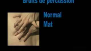 Percussion Savoir reconnaître la sonorité normale lors de la percussion dun thorax [upl. by Lleruj]