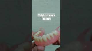 Valplast mode gasket dentist gigitiruan doktergigi vidioshorts [upl. by Dogs]