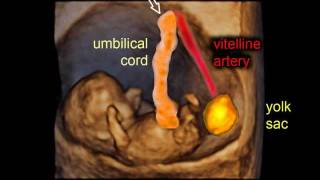 9 weeks of pregnancy gestational sac and embryo  3D scan [upl. by Nylaroc]