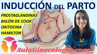 INDUCCIÓN DEL PARTO 💊 PROSTAGLANDINAS ⚽ BALÓN DE COOK OXITOCINA  Ginecología y Obstetricia [upl. by Pepillo]