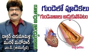 Clots in Heart Vessels  CAD  Prof Dr Murali Manohar Chirumamilla MD Ayurveda [upl. by Fakieh]