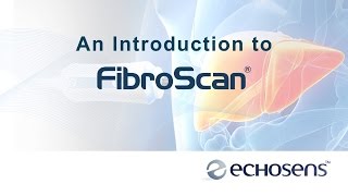 A Patients Introduction to FibroScan [upl. by Devan921]