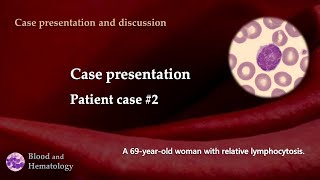 Patient case presentation case 2 [upl. by Aranaj708]