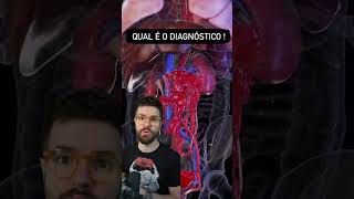 ✨ El tratamiento quirúrgico de la rotura de un aneurisma de la aorta abdominal [upl. by Yorle]