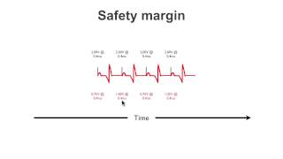 Pacemaker Issues Explained Part 1 Understanding Failure to Capture [upl. by Baoj304]