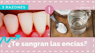 ENCIAS SANGRANTES E INFLAMADAS [upl. by Aileve]