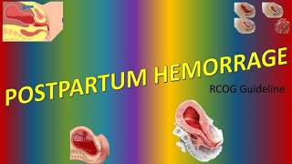 Postpartum Haemorrhage PPH RCOG Guideline [upl. by Wallraff]