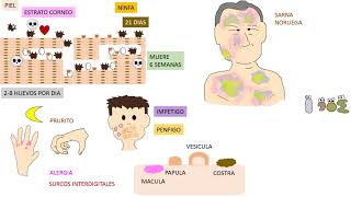 Sarna  Sarcoptes Scabiei [upl. by Ahrat]
