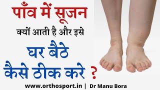 Ankle and Leg Swelling  घर बैठे पाइए एडी में सूजन पाँव में सूजन का सटीक इलाज Complete Info Hindi [upl. by Zindman903]