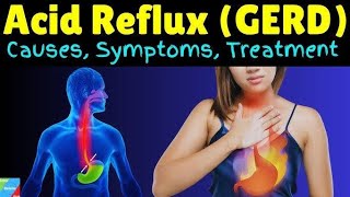 Gastroesophageal Reflux Disease GERD GNM  BSC NURSING [upl. by Eerrahs]