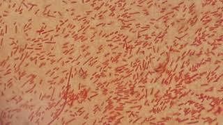 Gram negative bacteria [upl. by Kamerman]