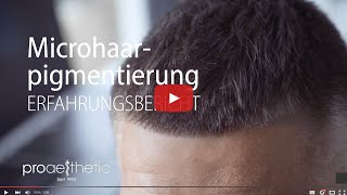 Microhaarpigmentierung gerader Haaransatz  Erfahrungsbericht  proaesthetic [upl. by Postman]